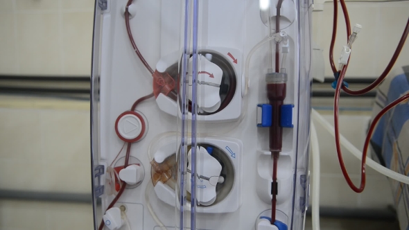 Hemodialysis Machines with Tubing. alt