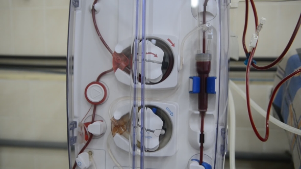 Hemodialysis Machines with Tubing.