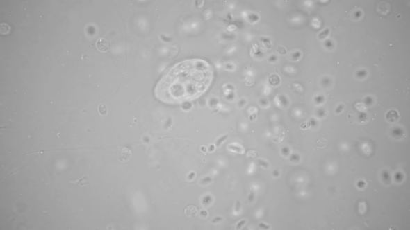 Transparent Microorganism Under the Microscope, with Internal Organs, As Is an Alien Organism alt