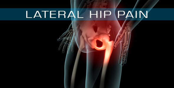 Lateral Hip Pain, Motion Graphics | VideoHive