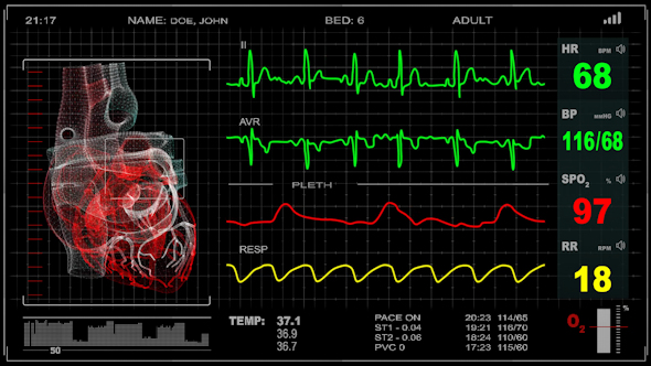 Cardiomonitor Animated 4K (7in1)