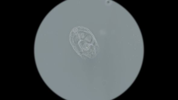 Microorganisms,the Inhabitants of the Aquarium Under the Microscope alt