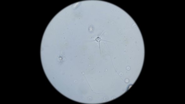 Microorganisms,the Inhabitants of the Aquarium Under the Microscope alt