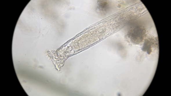 Microorganisms,the Inhabitants of the Aquarium Under the Microscope alt