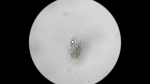 Microorganisms,the Inhabitants of the Aquarium Under the Microscope alt