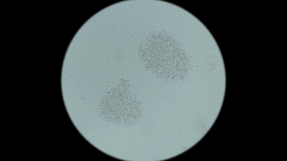 Colony of Bacteria-cadaveric Fingers Under the Microscope alt