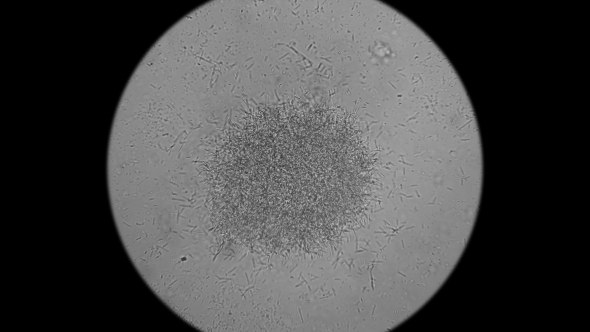 Colony of Bacteria-cadaveric Fingers Under the Microscope alt