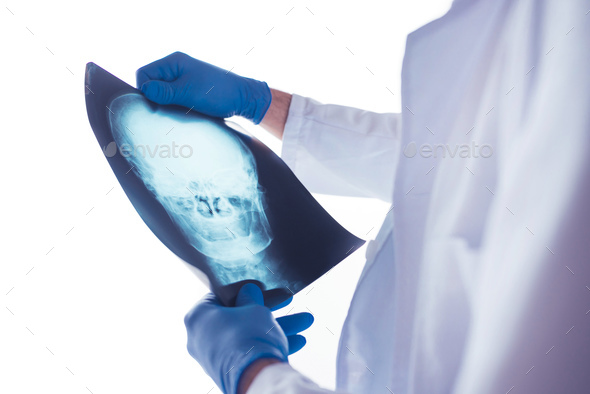 Doctor examining x-ray of the skull - Stock Photo - Images