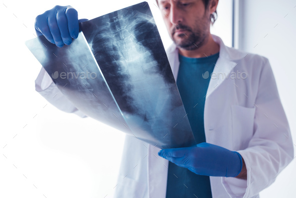 Doctor examining x-ray of the human spine - Stock Photo - Images