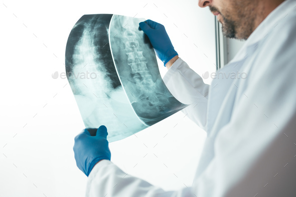 Doctor examining x-ray of the human spine - Stock Photo - Images