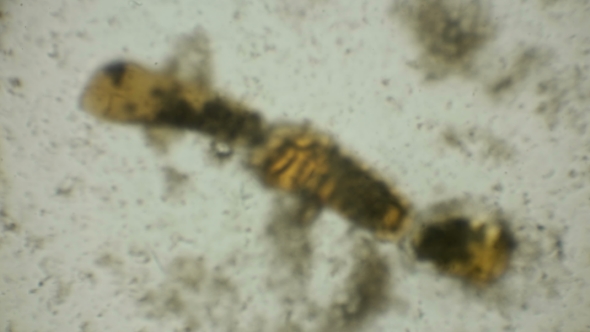 Eggs of Microorganisms in a Protected Shell Under a Microscope alt