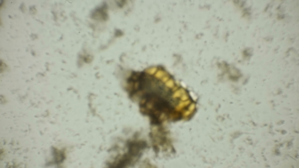 Eggs of Microorganisms in a Protected Shell Under a Microscope alt