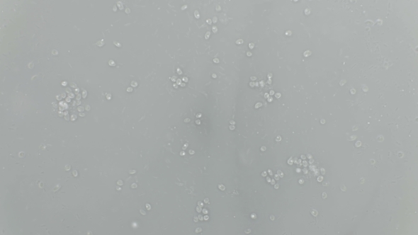 a Large Colony of Protozoa Moves Under a Microscope alt