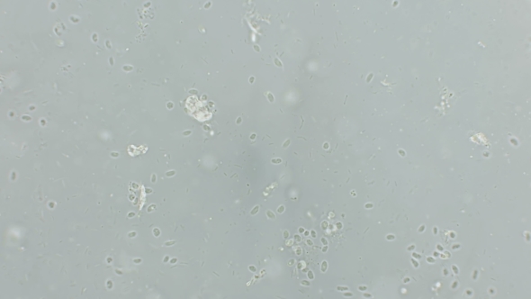 Large Colony of Protozoa Moves Under a Microscope alt