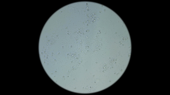 a Large Colony of Protozoa Moves Under a Microscope alt
