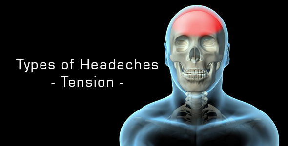 Types Of Headaches - Tension, Motion Graphics | VideoHive