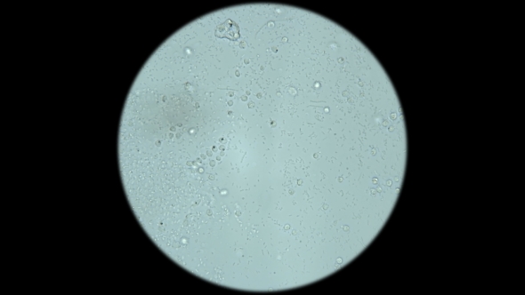a Large Colony of Protozoa Moves Under a Microscope alt