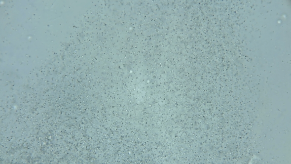 a Large Colony of Protozoa Moves Under a Microscope alt
