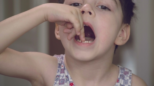 The Boy Is Staggered By a Milk Tooth. The Tooth Is About To Fall Out