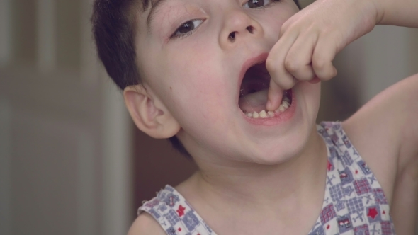 The Boy Is Staggered By a Milk Tooth The Tooth Is About To Fall Out