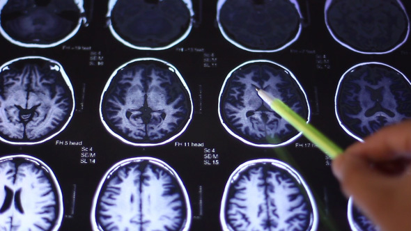 Doctor Examines Human Brain MRI Scan On Touch Screen Computer