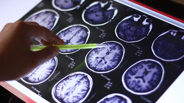 Doctor Examines Human Brain MRI Scan On Touch Screen Computer