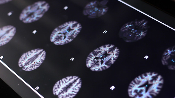 Doctor Examines Human Brain MRI Scan On Touch Screen Computer