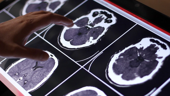 Doctor Examines Human Brain MRI Scan On Touch Screen Computer