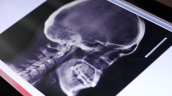 Doctor Examines Human Brain Fluorography Scan On Touch Screen Computer