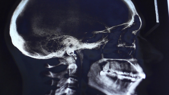 Doctor Examines Human Brain Fluorography Scan On Touch Screen Computer