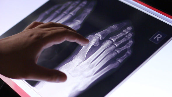 Doctor Examines Human Feet Bones Fluorography Scan On Touch Screen Computer