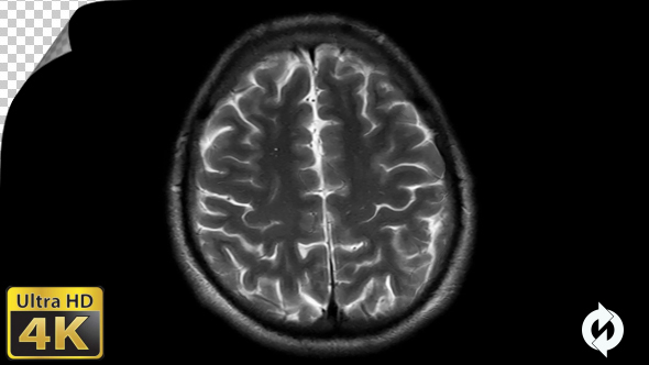 Human Brain MRI Scan - Alpha Channel