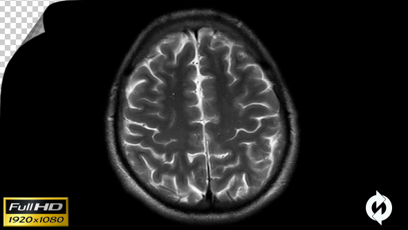 Human Brain MRI Scan - Alpha Channel