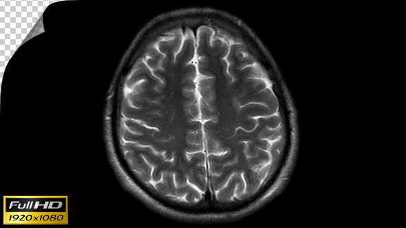 Human Brain MRI Scan - Slow Version - Alpha Channel