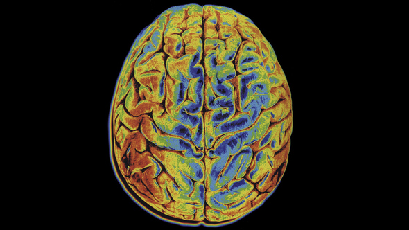 Colorful Changing Scan Of Human Brain