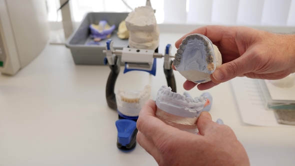 Orthodontist Shows Model of Dental Jaw on Background of Workplace with Modern New Equipment alt