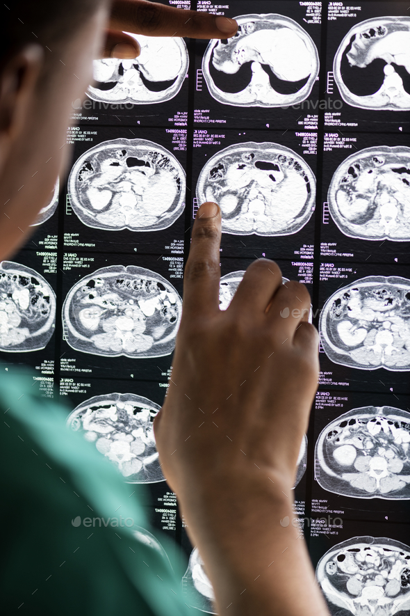 Doctor reading brain MRI x-ray result Stock Photo by Rawpixel | PhotoDune