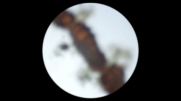 Eggs of Microorganisms in a Protected Shell Under a Microscope alt