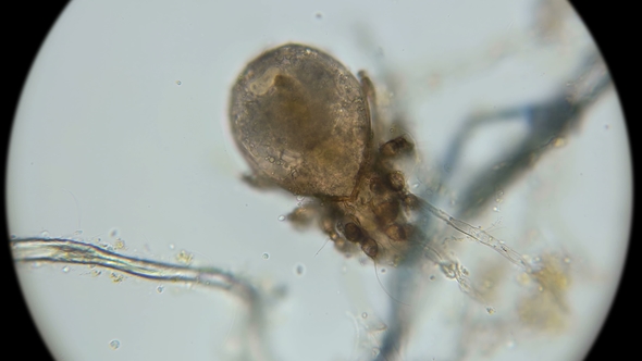 Dead Dust Mite Became the Habitat of Microorganisms, Under a Microscope alt