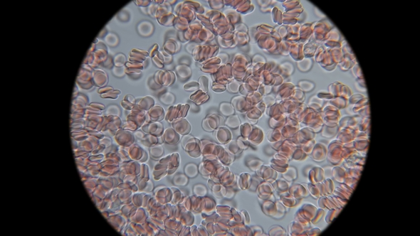 Movement of Blood Under the Microscope alt