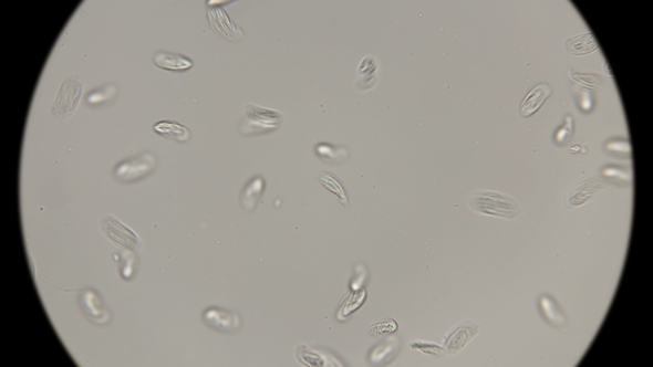 Large Colony of Protozoa Moves Under a Microscope alt