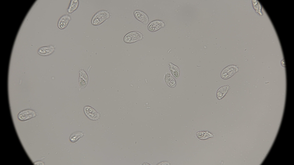 Large Colony of Dead Protozoa Under a Microscope alt
