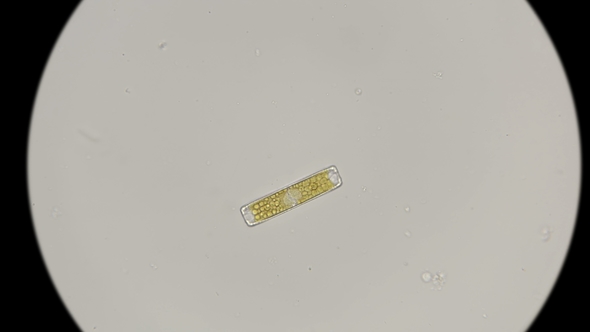 Diatom Algae in Fresh Water, Under a Microscope alt