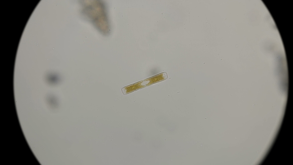 Diatom Algae in Fresh Water, Under a Microscope alt