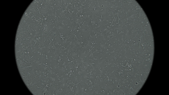 Colony of Bacteria-cadaveric Fingers Under the Microscope alt