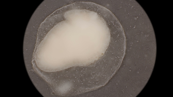 Colony of Bacteria-cadaveric Fingers Under the Microscope alt