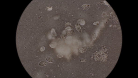 Large Colony of Protozoa Moves Under a Microscope alt