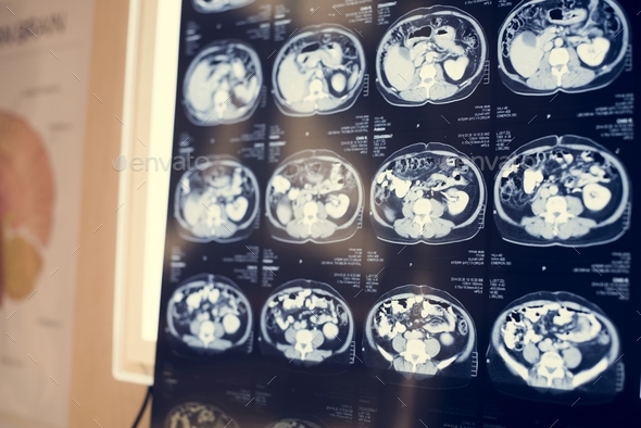 Brain CT scan x-ray film Stock Photo by Rawpixel | PhotoDune