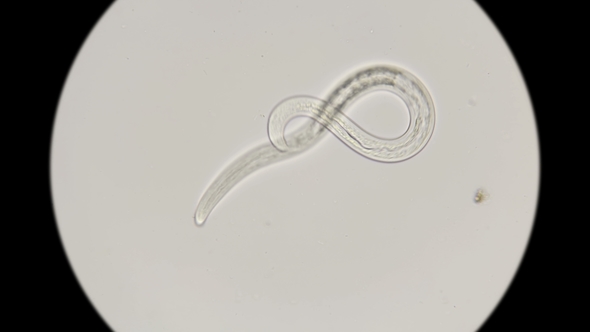 Nematode Worm Under a Microscope alt