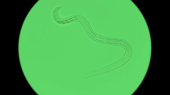 Nematode Worm Under a Microscope alt